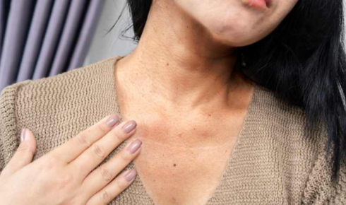 Treating Body Pigmentation: Neck, Underarms and Back Darkness Explained